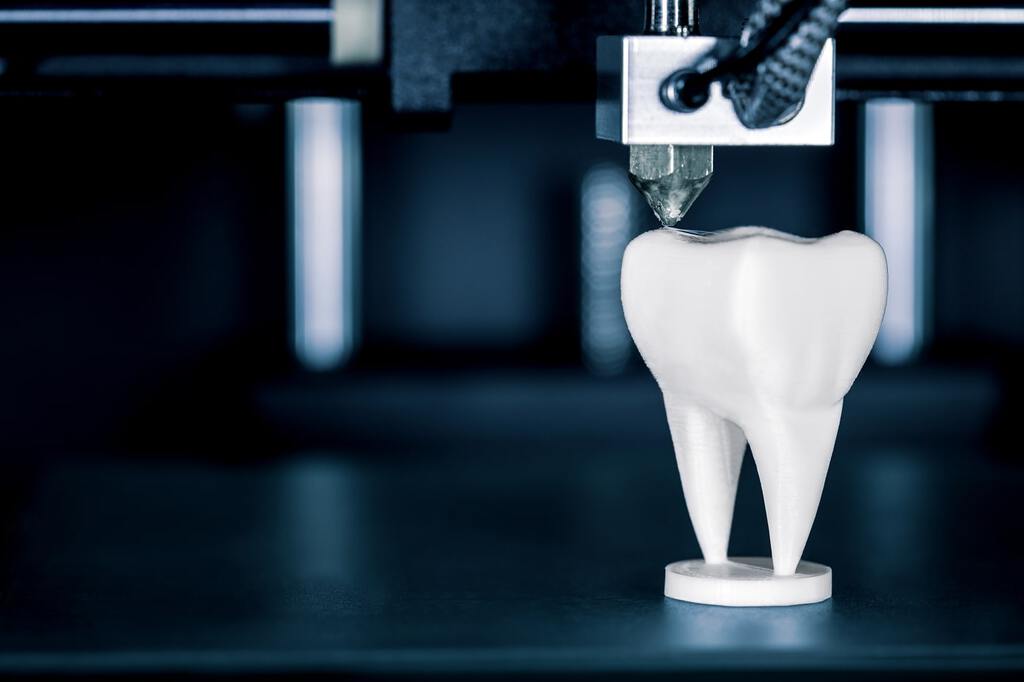 Modell eines Zahnes in 3D. An der linken oberen Spitze der Arm des 3D Druckers, der gerade das Modell fertigstellt.