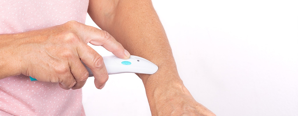 bite away ist sehr populär, doch vor allem Kindern unangenehm | © zaschnaus - stock.adobe.com Eine Frau wendet den Hitzestift von bite away aufgrund eines Stichs auf ihrem Unterarm an